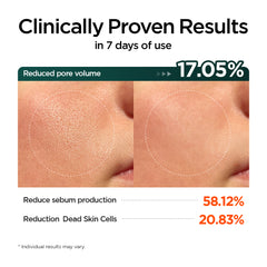 P.CALM Cica Lactobacilus Acne-Prone Toner Pad