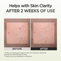 P.CALM Spot Correcting Serum 30ml