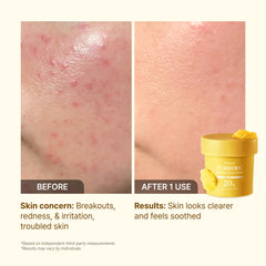 P.CALM Turmeric Bubble Deep Mask 90g